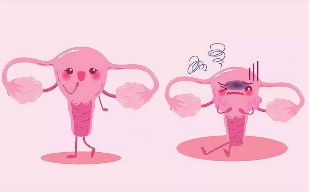 女生底裤发黄发硬怎么回事,女性裤头发黄是什么原因