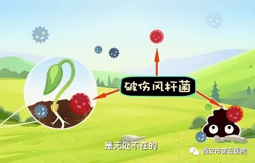 破伤风是因为伤口见风了吗,破伤风是伤口受风引起吗