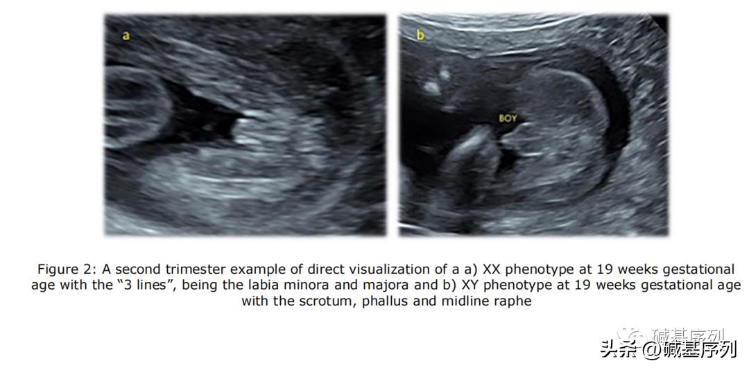 怀孕了第一胎宝宝会知道么,怀孕胎儿外貌什么时候确定