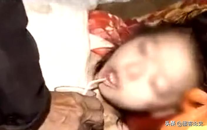 四川11岁骨结核女孩现状,四川11岁女孩骨结核