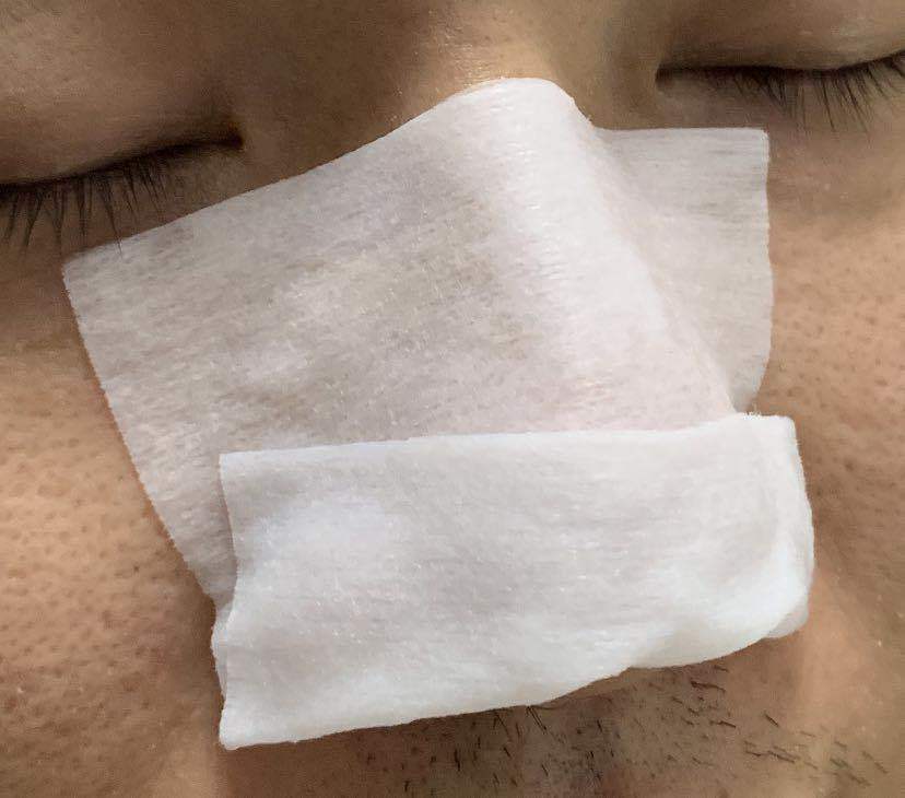 鼻子上油脂粒去除后怎么收缩毛孔,鼻子上长了个类似痘的东西