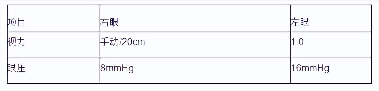 重现光明换眼手术,眼科医生帮助患者恢复光明