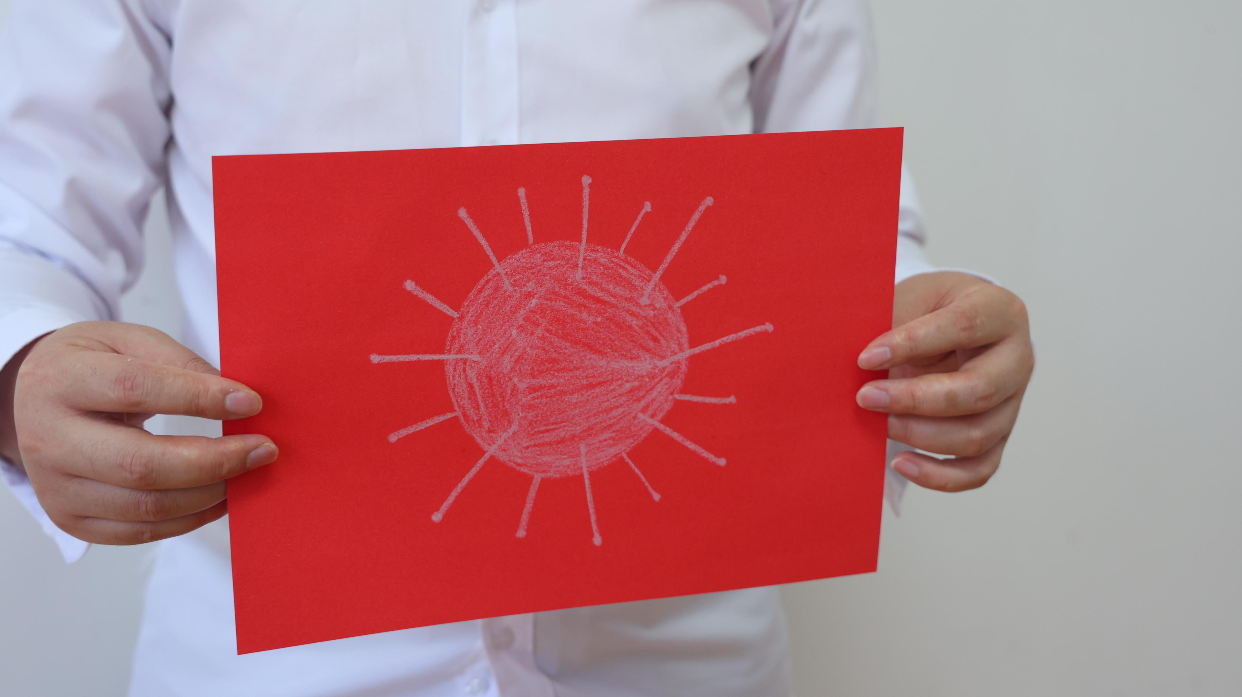 外阴鳞状上皮细胞增生怎么引起的,外阴鳞状上皮细胞增生有什么治疗