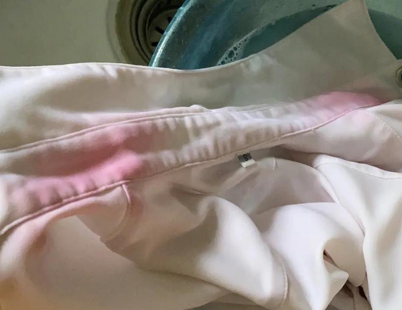 女裤总是湿湿的如何治疗,女裤上发黄有异味什么原因