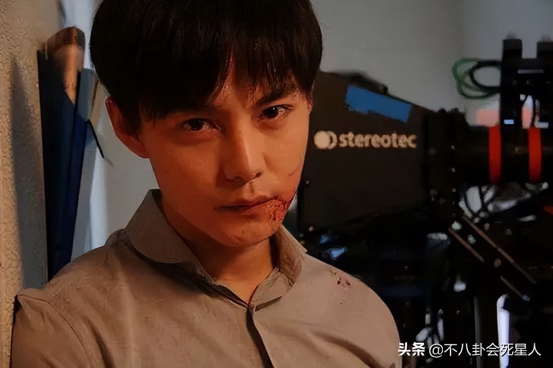 脸部垮掉的男人,脸部塌陷的男生