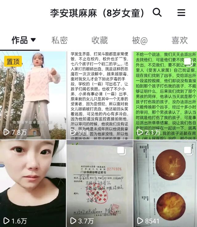 8岁女童被弹弓射伤失明23日,8岁女童被弹弓射伤失明母亲