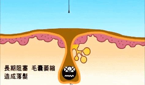 生姜洗发水去屑止痒控油防脱生发,生姜洗发水防脱生发增发效果好吗