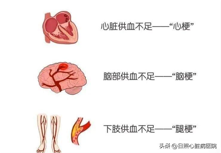 腿脚发凉别大意可能是大病,腿脚冰凉是不好的征兆吗