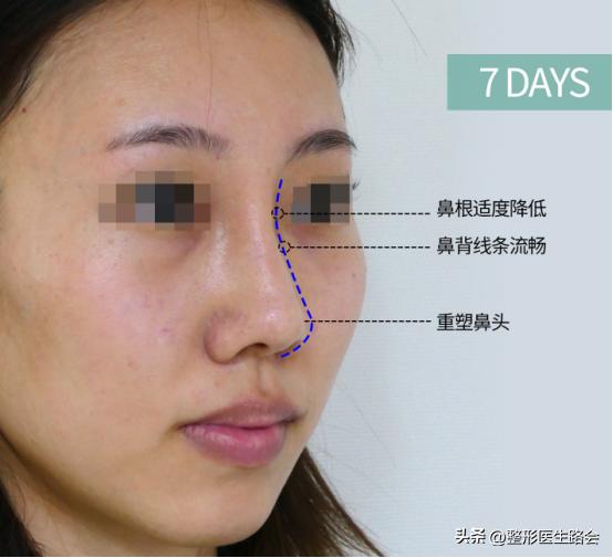 一时冲动做的决定后悔了,一时冲动做出错误的选择