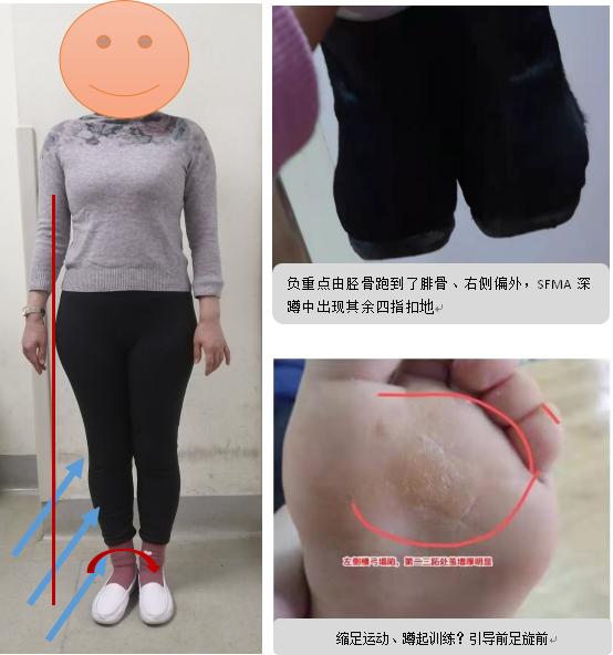 产后康复运动,产后康复加盟