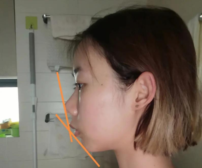 同样都是“凸嘴”，为什么有人风情万种，有人一股土味？答案在这