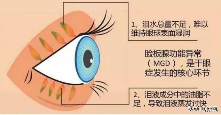 怎么才能让眼睛变成蓝色星星眼,眼睛还能变成星星眼吗
