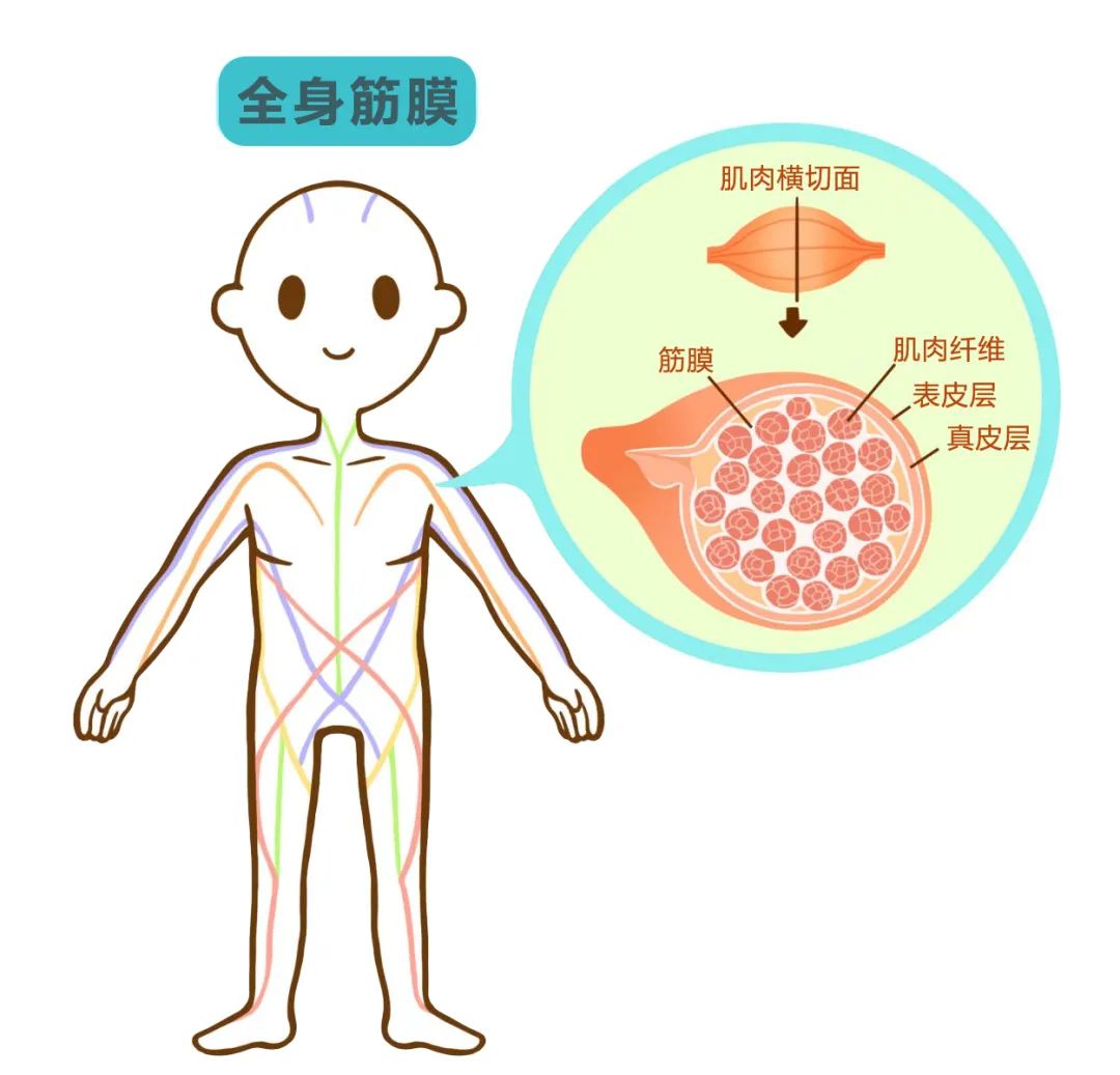 筋膜炎会腰酸背痛吗,腰酸背痛筋膜炎最好的恢复办法