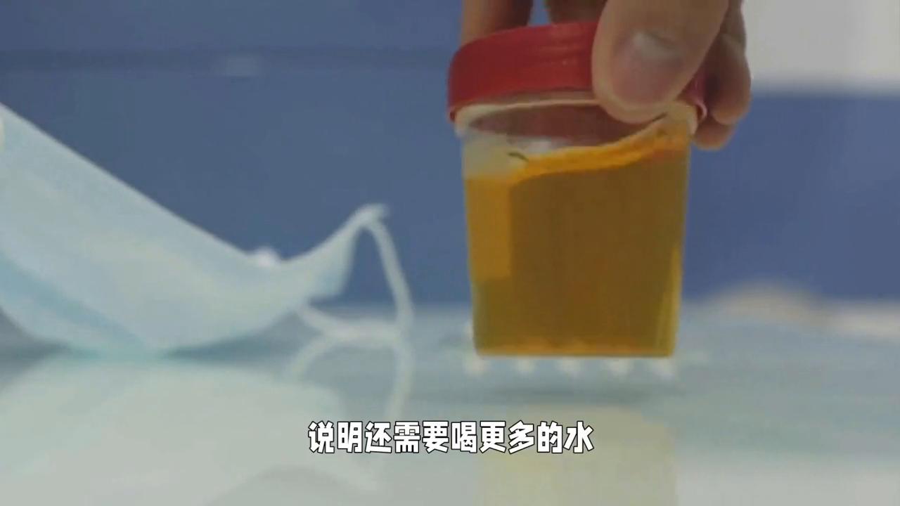 看便便了解宝宝健康状况,育儿知识婴儿大便