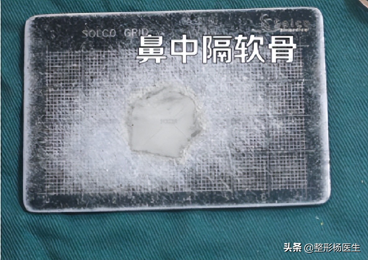 注射隆鼻和假体隆鼻哪个好,隆鼻和综合隆鼻整形有什么区别