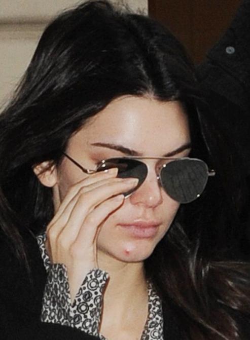 假期治痘最佳时期,如何快速消除熬夜痘