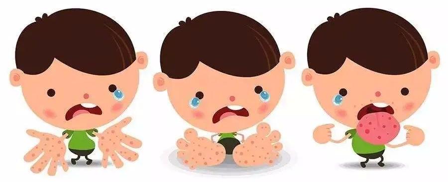 手足口病诊疗指南总结,手足口病诊疗指南及解读