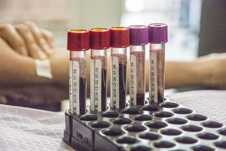 血常规血小板数偏高会是癌吗,血小板计数增高诊断