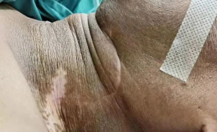 花都中医院病例,花都有多少病例