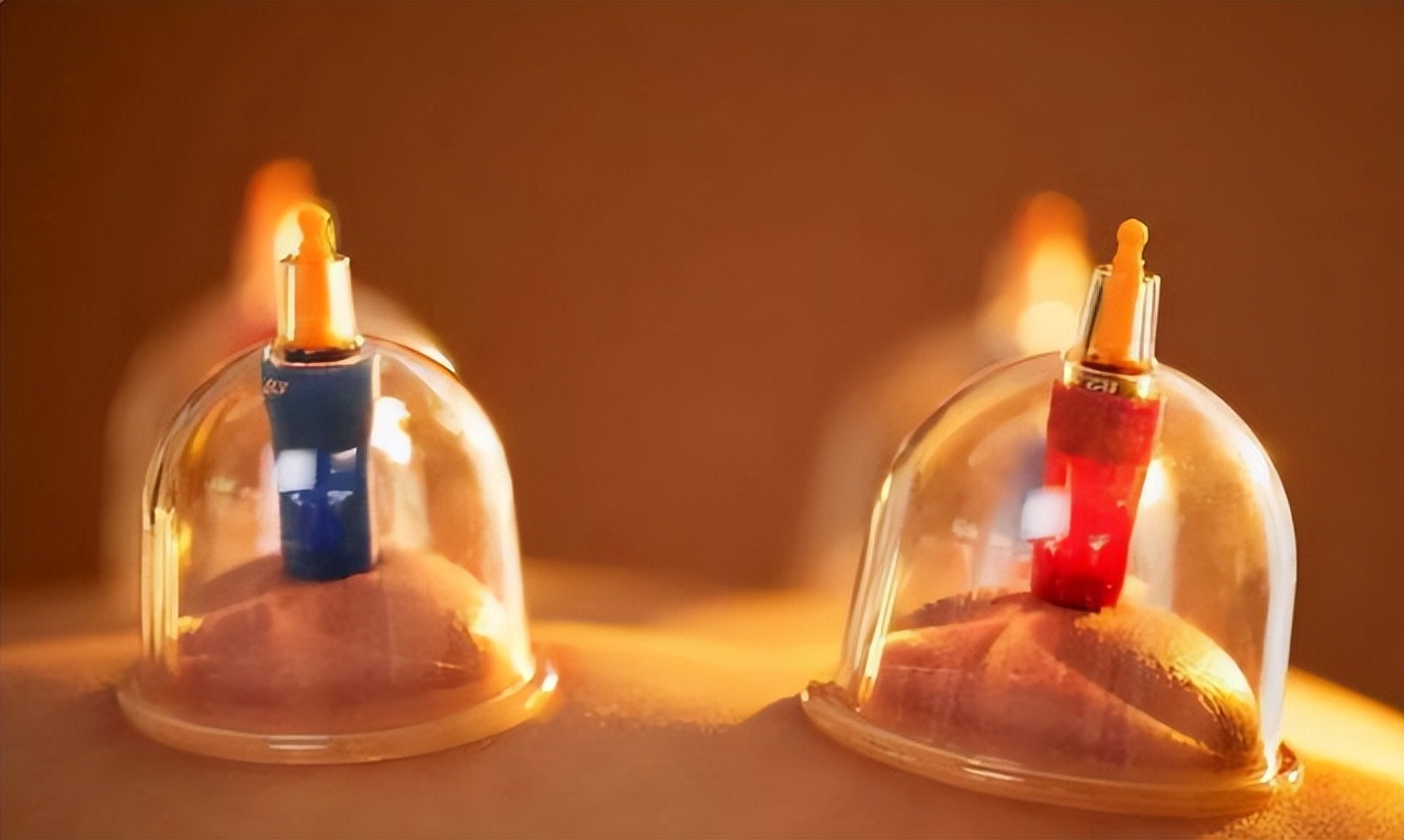 拔火罐出现的瘀血，是体内的毒素吗？