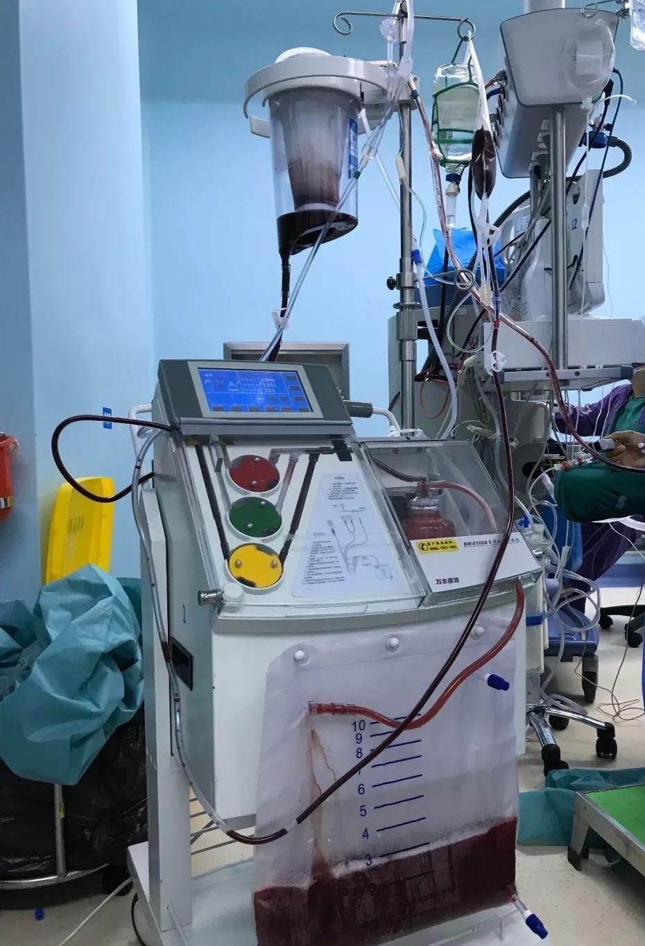 依靠血型判定亲子关系靠谱吗？咋遇到这种血型就翻车了