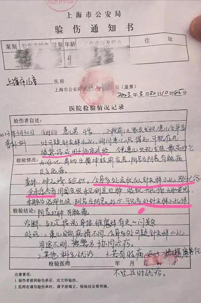 上海幼儿园多名幼童疑遭虐待针尖小孔、利多卡因，发中含有麻黄碱