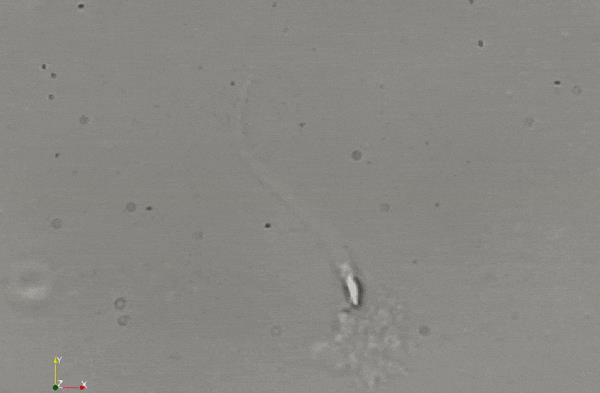 精子的活动轨迹讲解,精子的轨迹分析