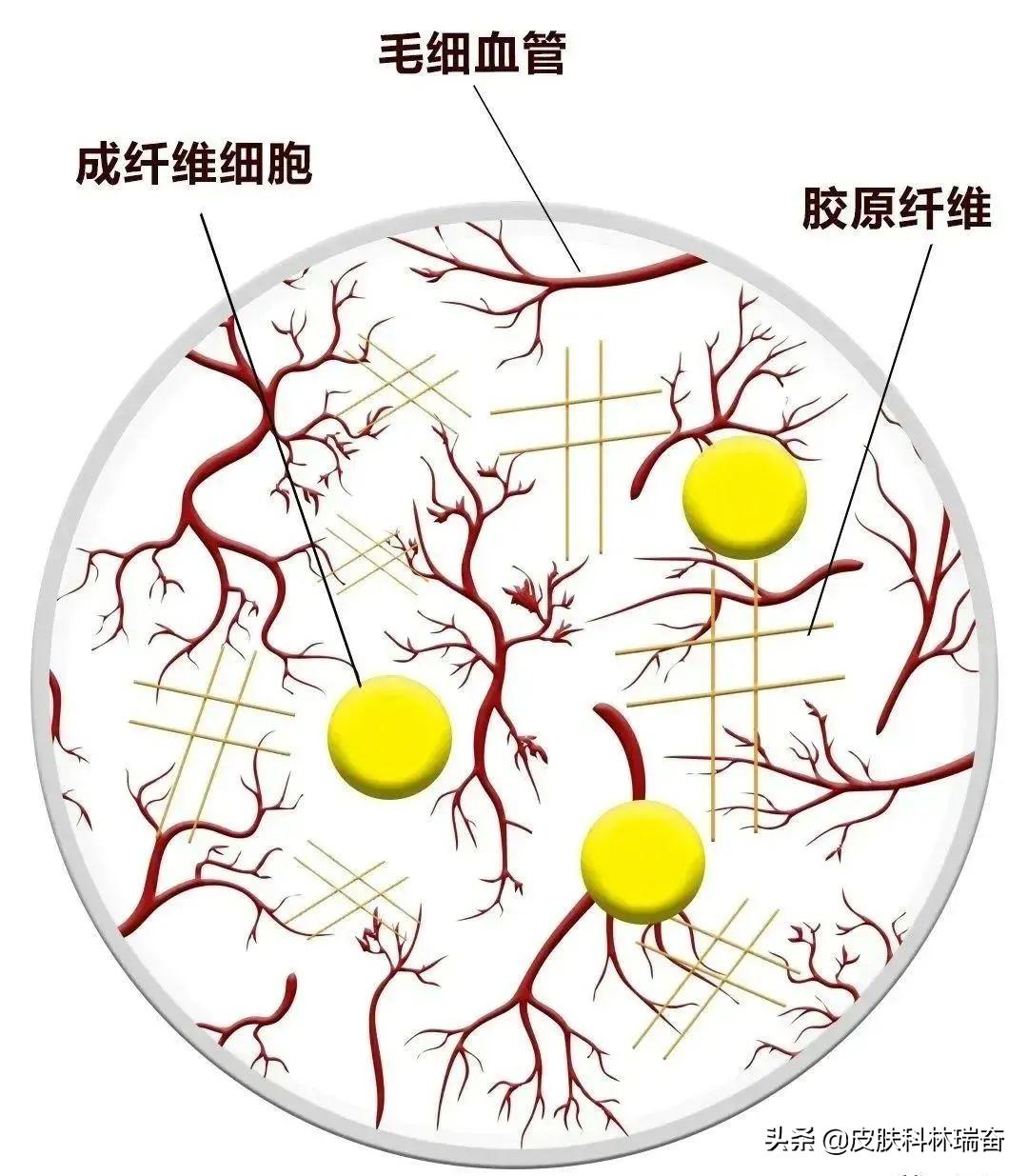 疤痕疙瘩不断的长怎么办,疤痕疙瘩不停增长怎么办