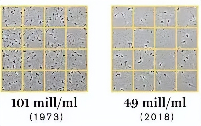 全球男性生育率断崖式下跌,半世纪男性生育力