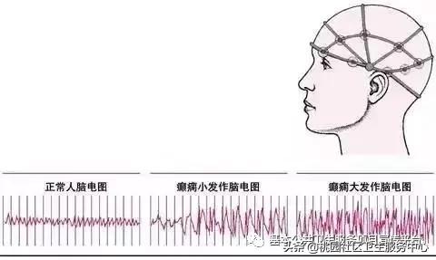 五分钟带你了解癫痫发展史,2024年卫生健康主题宣传日一览表