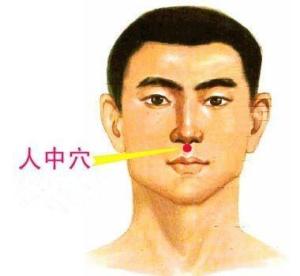 高温天气中暑之后掐人中有用吗,中暑急救喝热水