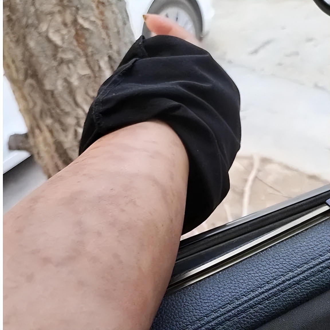 百病从肝治的中医,百病从肝治之四