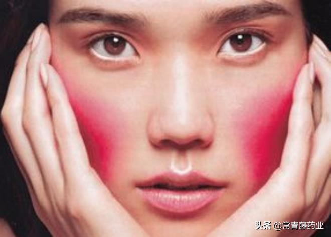 脸蛋泛红不痛不痒是怎么回事,玫瑰痤疮脸上泛红怎么治疗