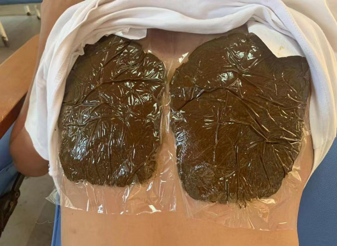 福清市中医治疗儿童咳嗽有效方法,湛江哪个老中医治疗儿童咳嗽厉害