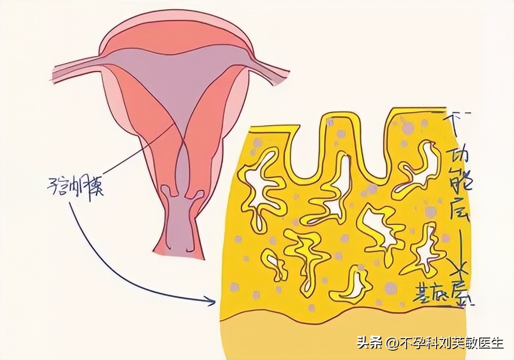 胚胎最爱什么样的内膜？怎么把薄内膜养成好内膜！