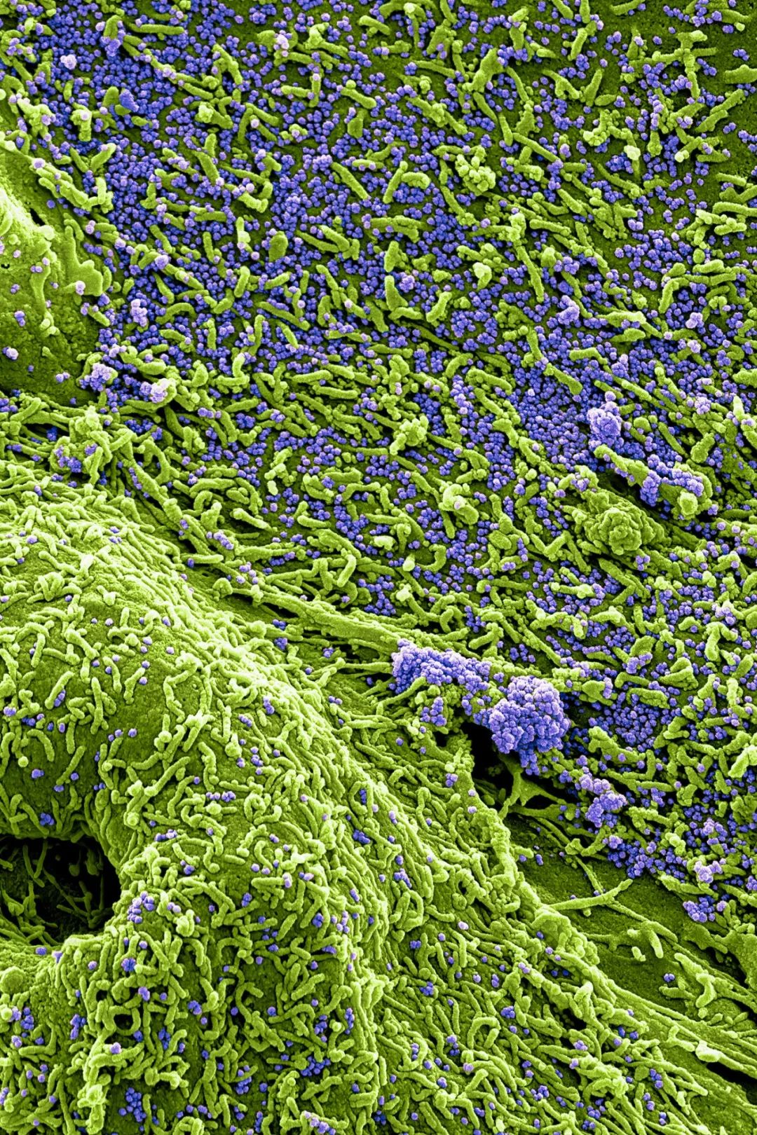 致与病毒搏斗的你！