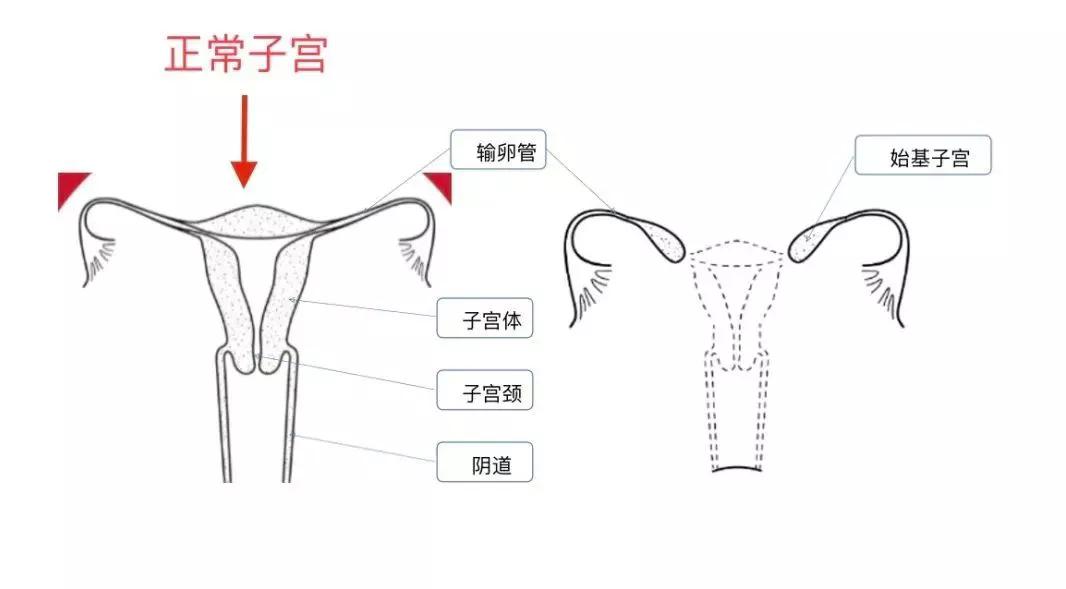 我没有子宫,我没有子宫了