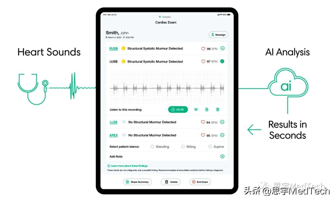 设备AI听诊器,ai听诊器怎么做