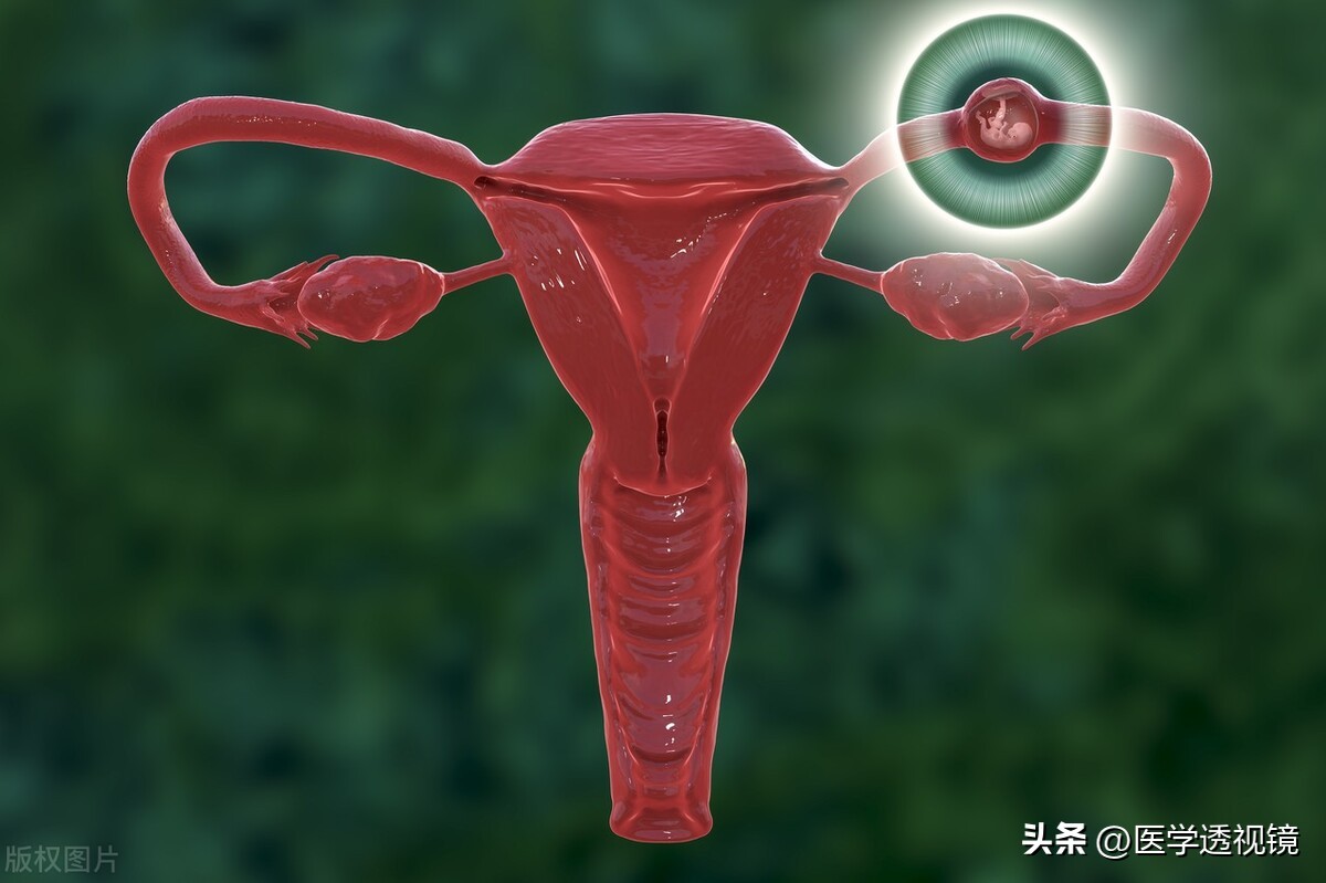 宫外孕诊断成肠胃炎可以告么,妇科病可以挂消化内科吗