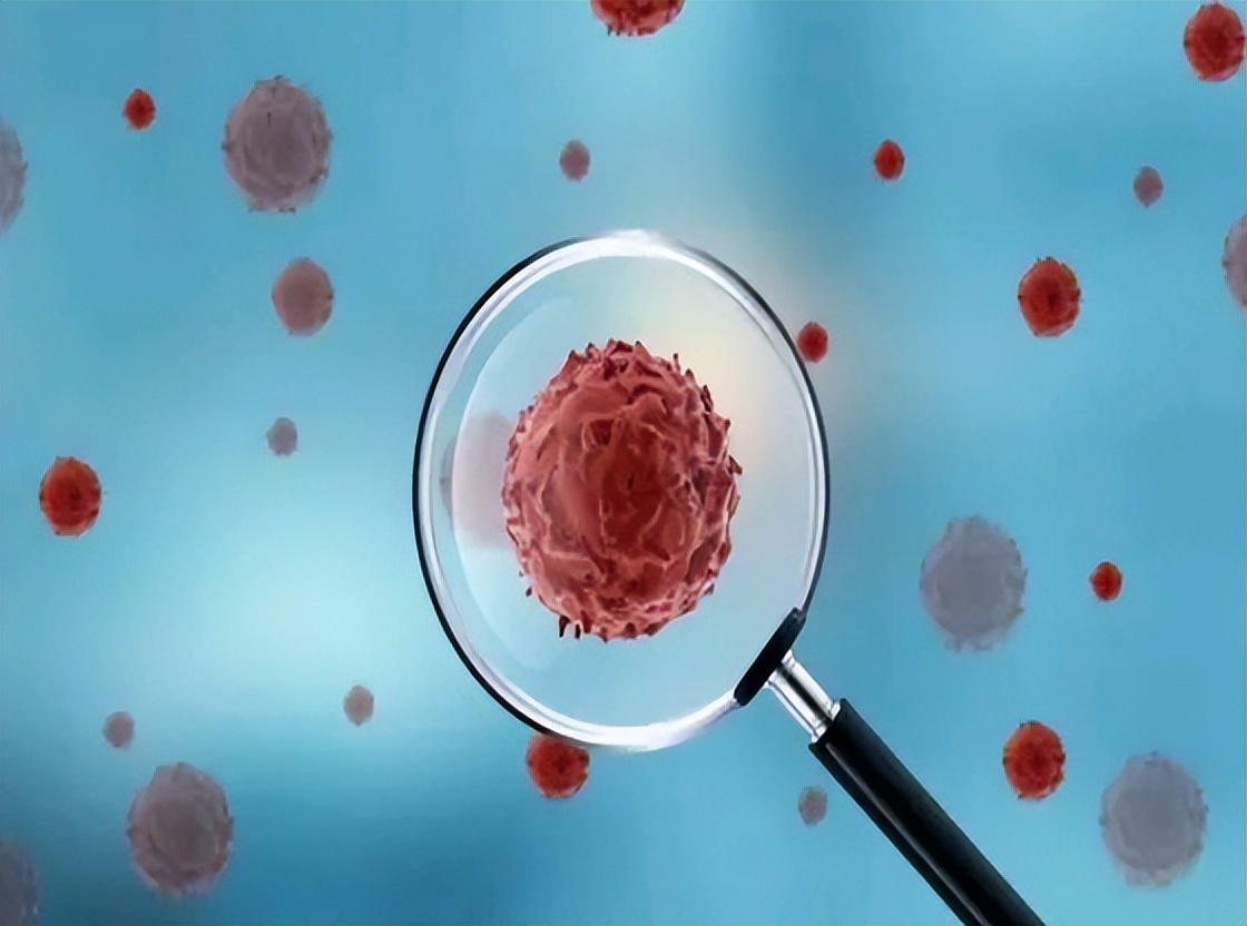 慢性炎症或可增加患癌风险，如何“消炎”？做好这7点