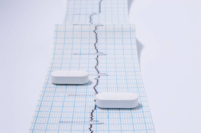 治疗心律失常的中成药有哪些,治疗心律失常哪种药可以常吃