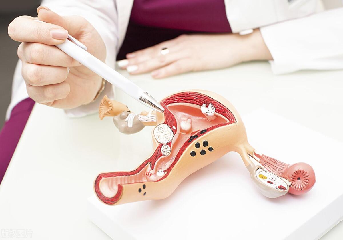 妇科炎症经常塞药有危害吗,女性妇科系统感染