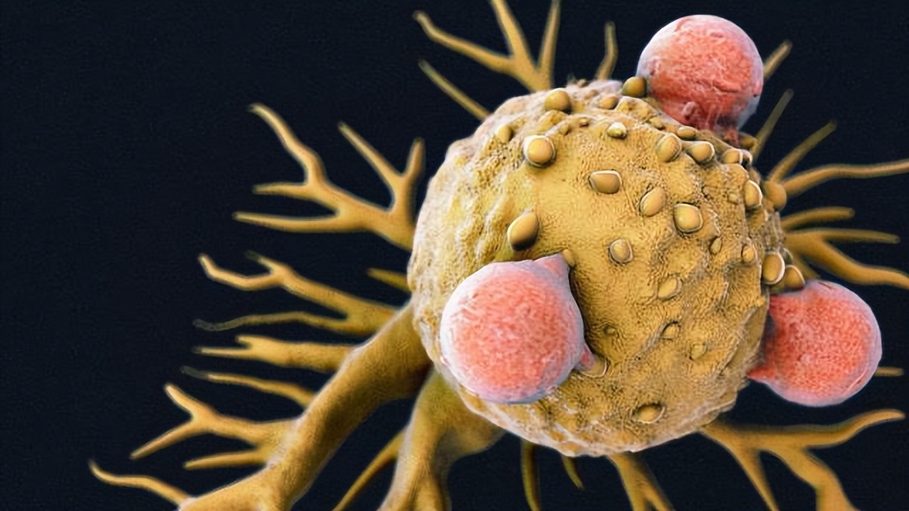 冰箱冻时间长的肉吃了致癌吗,经常吃冰箱冻肉的危害