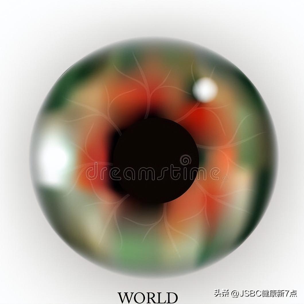 右眼看灯光有彩虹光圈,青光眼彩虹光圈是什么