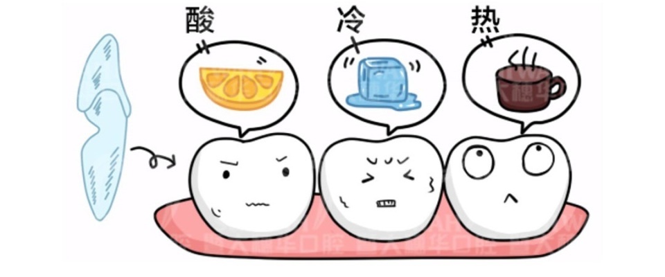 牙齿一吃冷热酸甜牙就敏感,冷热酸甜啥都不能吃怎么办
