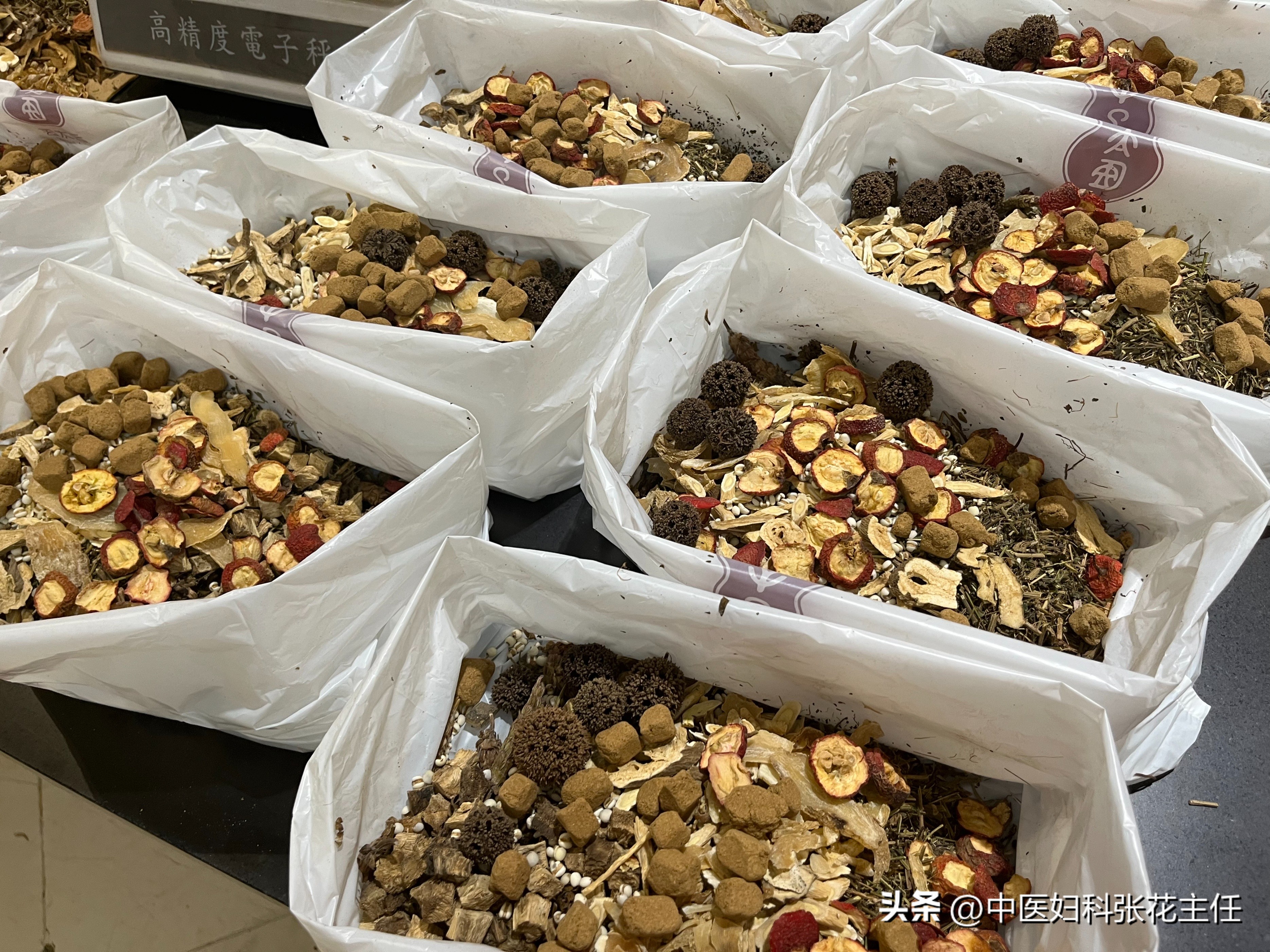 囊肿可以随便切吗,生孩子可以顺便切除囊肿吗