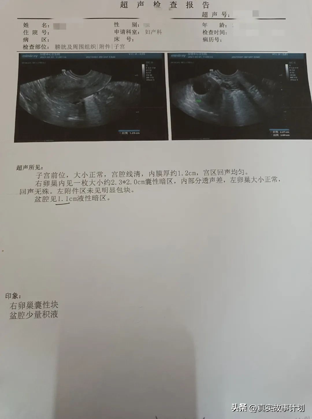 当医生公开谈论妇科病
