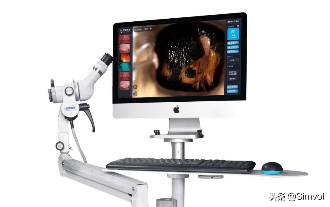 CSCCP安徽站，高清阴道镜助力医生攻克宫颈癌