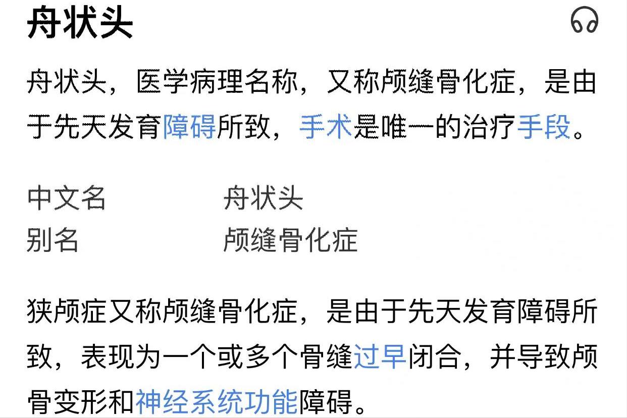 宝宝睡漂亮头型,宝宝应该怎么睡头型才好看