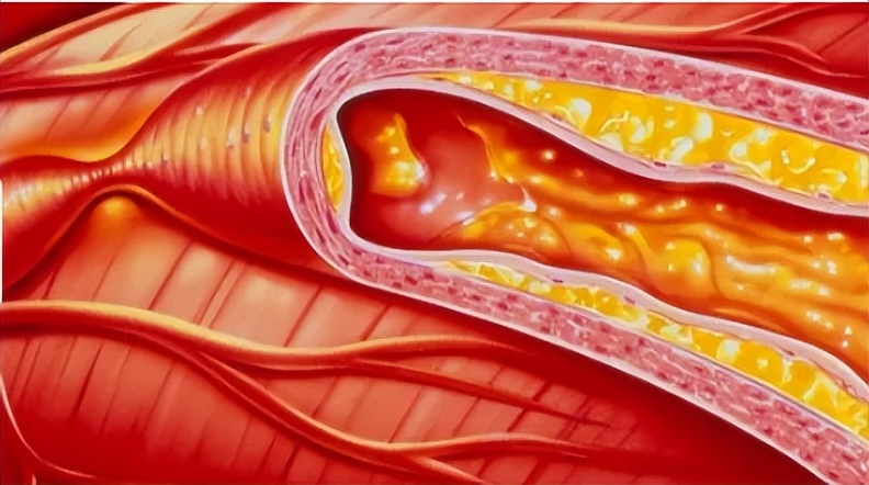 身体出现6个症状暗示猝死降临,身体出现这6种信号警惕猝死